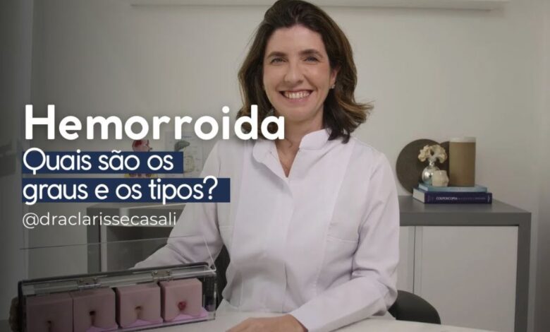 Hemorroida: Quais São os Graus e Tipos?